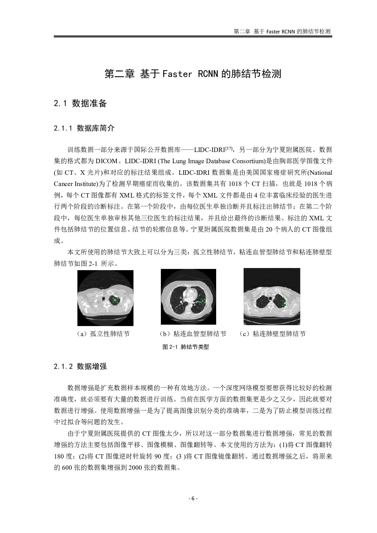 5.17基于CT图像的肺结节自动检测模型研究与实现-4604字.pdf 第10页