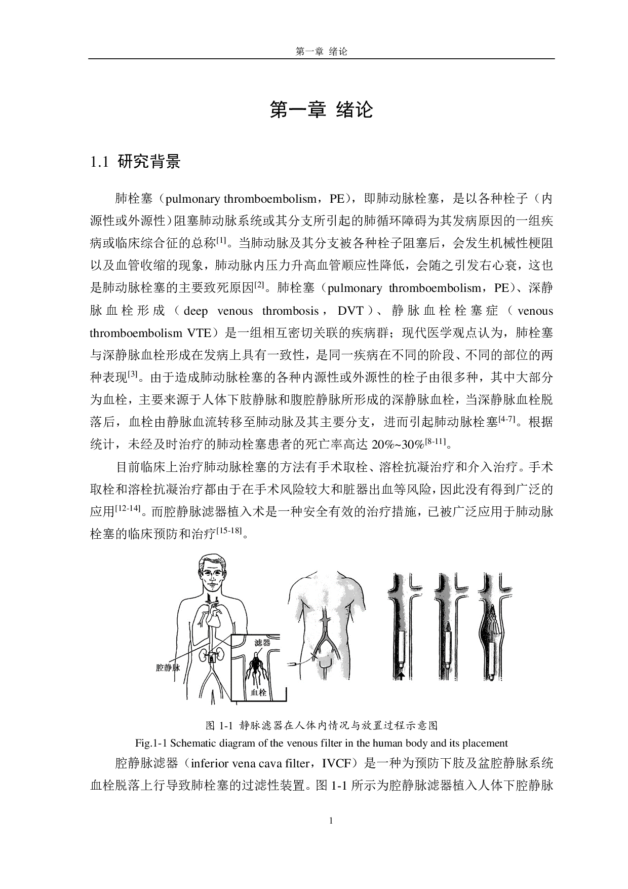 不同工况下腔静脉滤器疲劳强度的对比研究-3513字.pdf 第1页