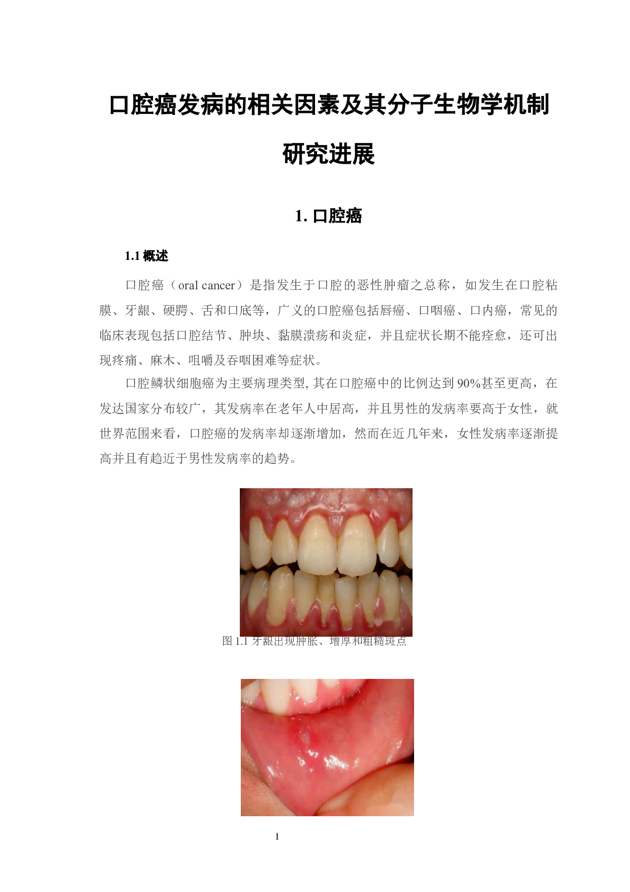 口腔癌发病的相关因素及其分子生物学机制研究进展-8745字.docx 第5页