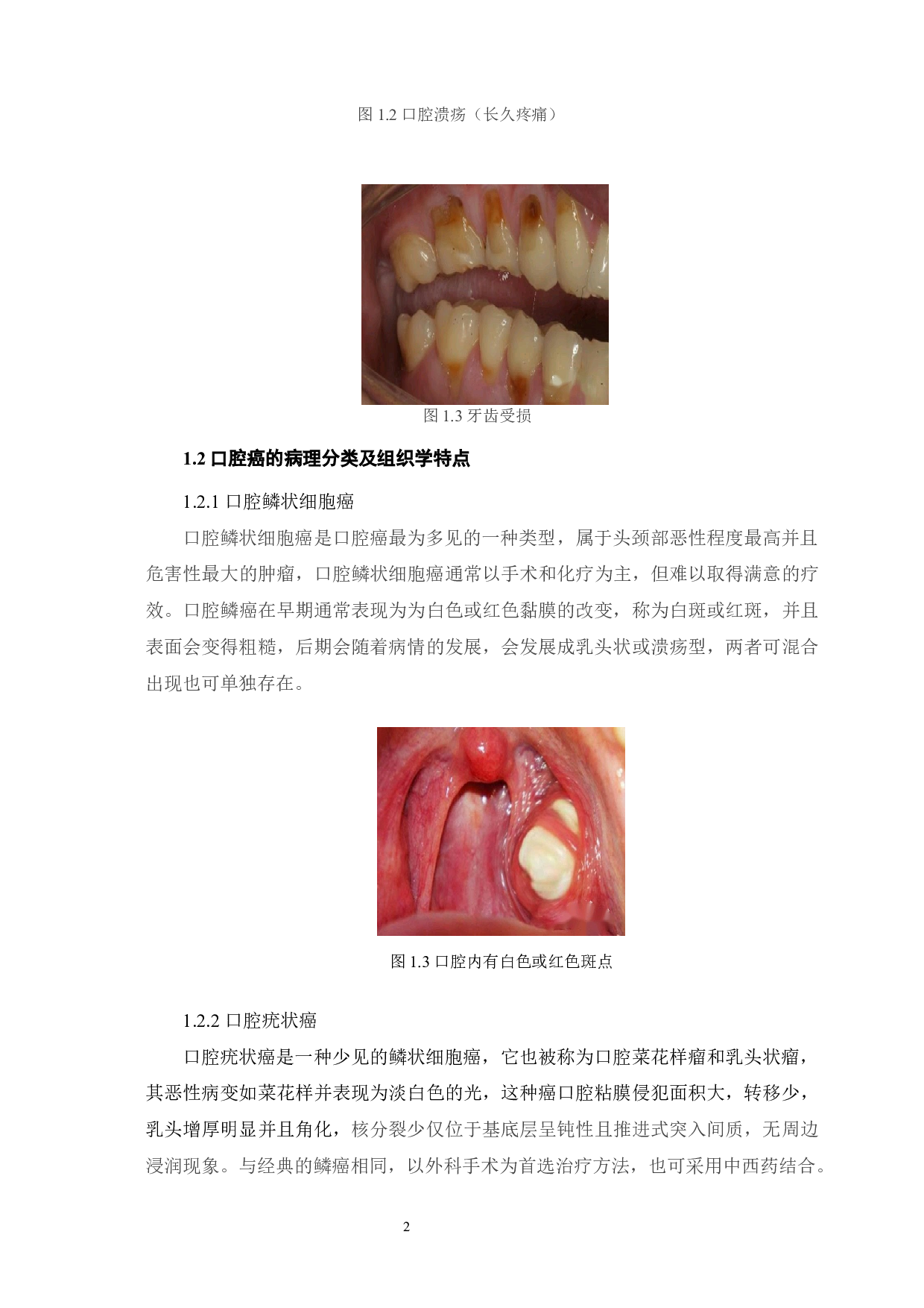 口腔癌发病的相关因素及其分子生物学机制研究进展-8745字.docx 第6页