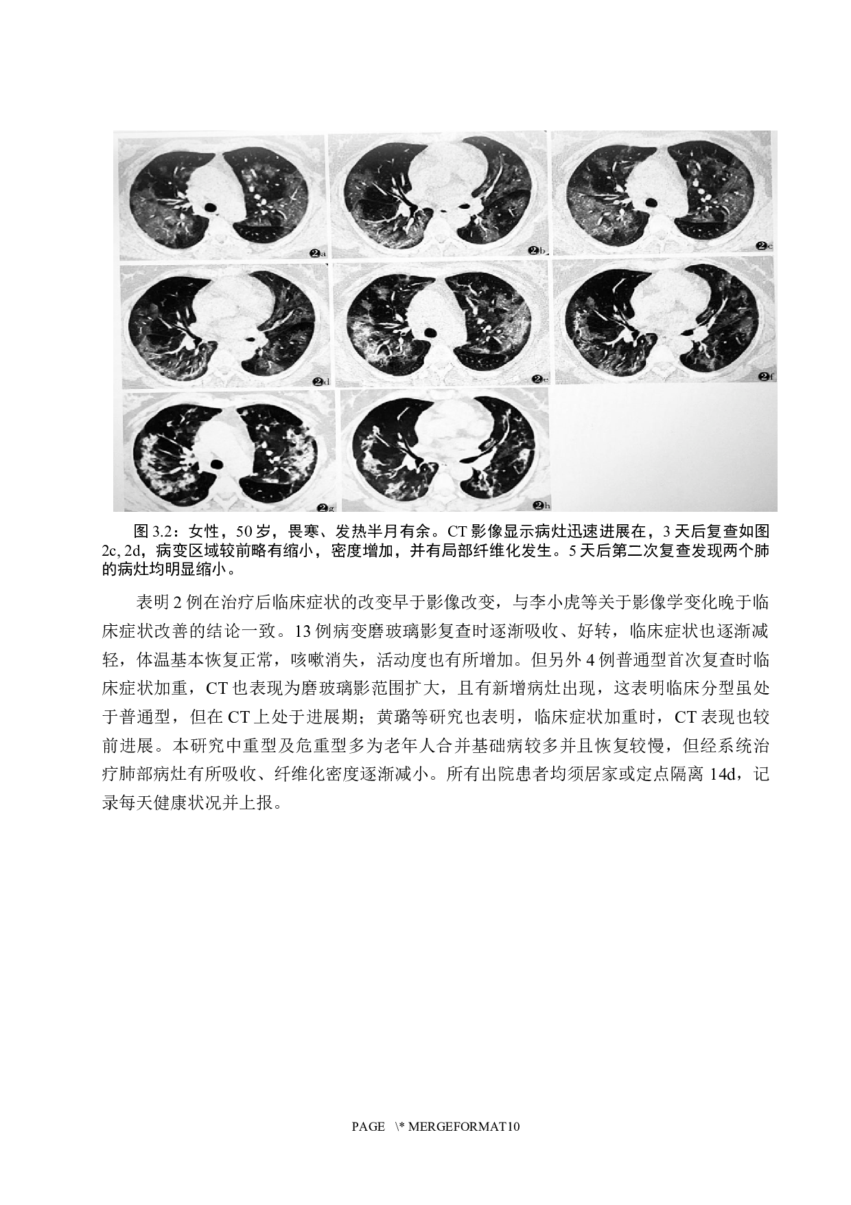 CT检查技术在病毒性肺炎的应用价值-9846字.docx 第9页