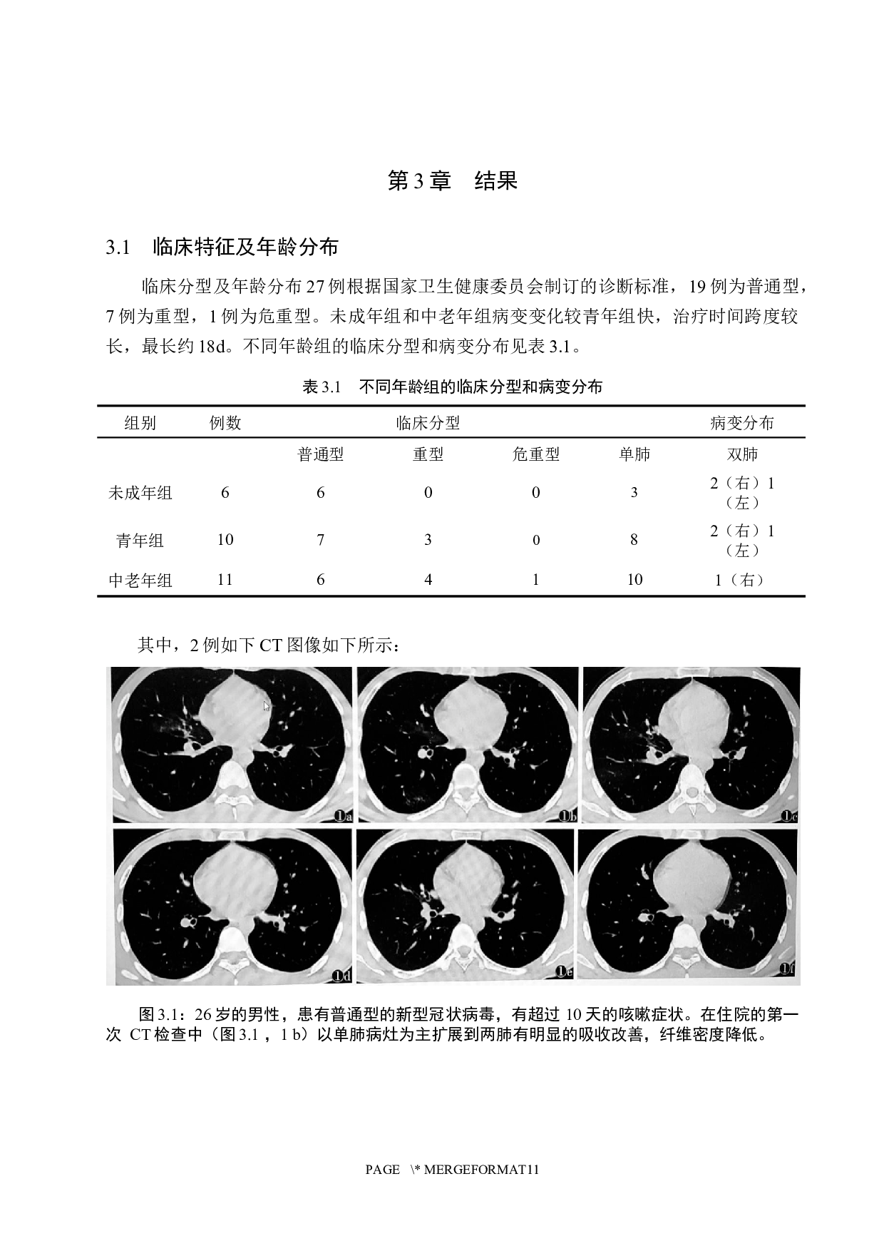 CT检查技术在病毒性肺炎的应用价值-9846字.docx 第8页
