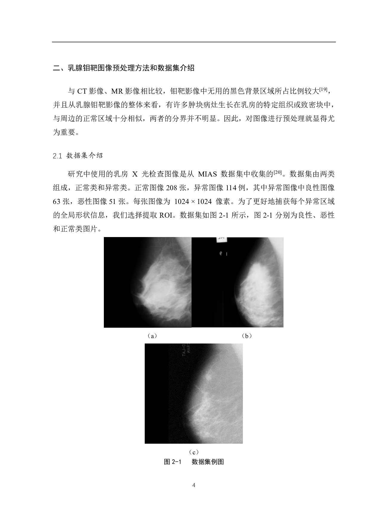 基于卷积神经网络的乳腺肿瘤分类算法研究-12763字.pdf 第7页