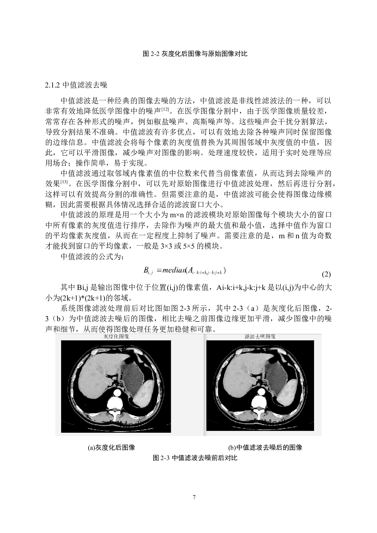基于GUI界面的医学图像分割系统搭建-22554字.docx 第10页