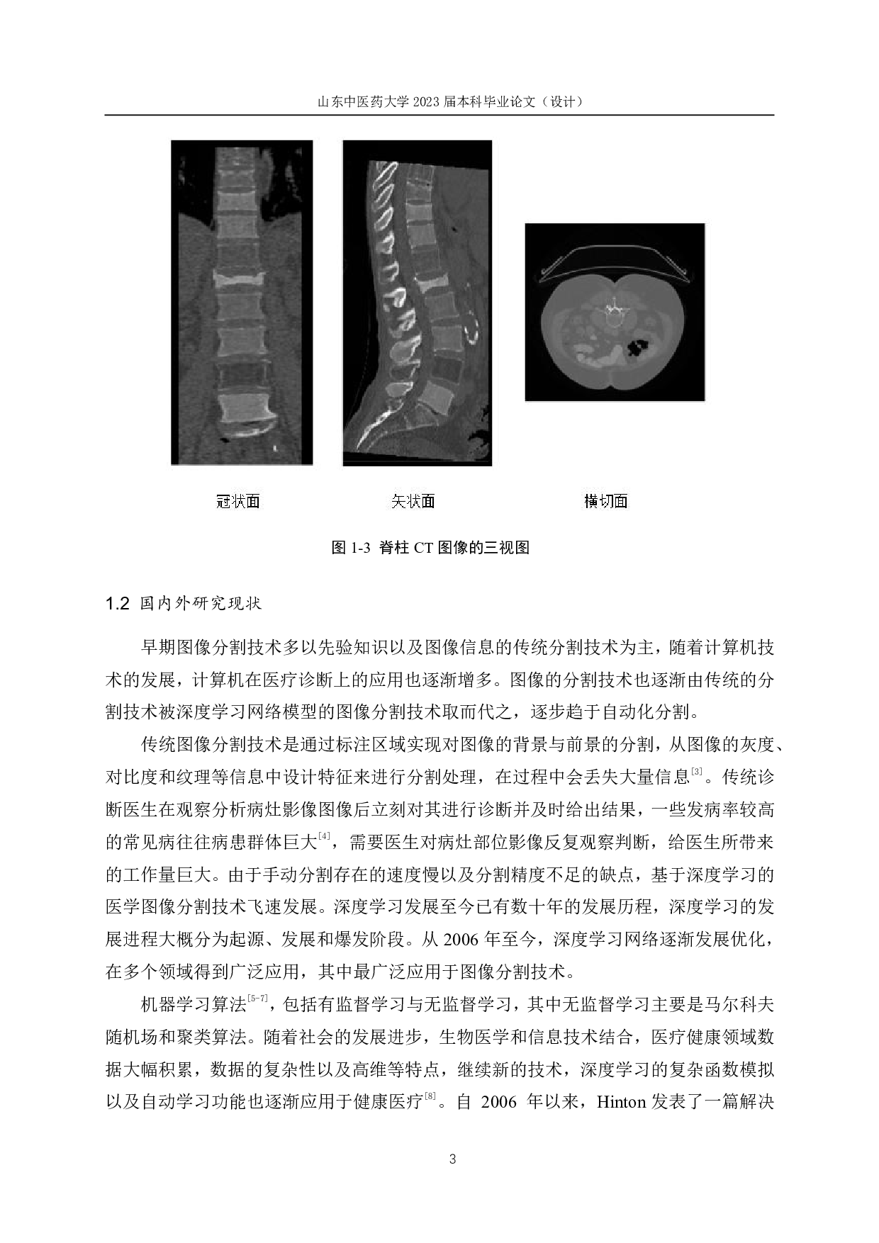 基于深度学习的脊柱图像分割技术研究-14027字.pdf 第7页