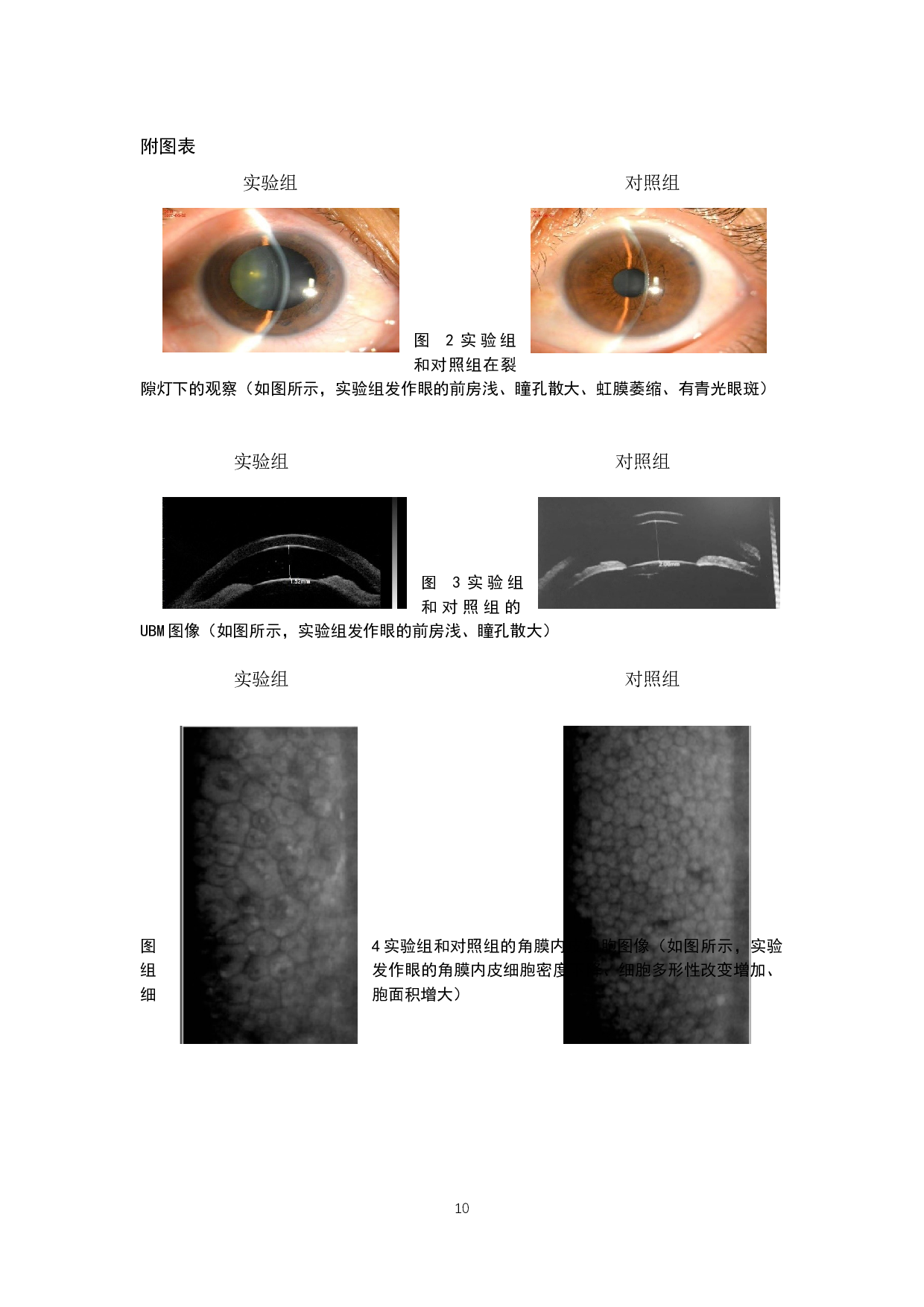 原发性急性闭角型青光眼急性发作期角膜内皮细胞的临床研究-9048字.docx 第10页