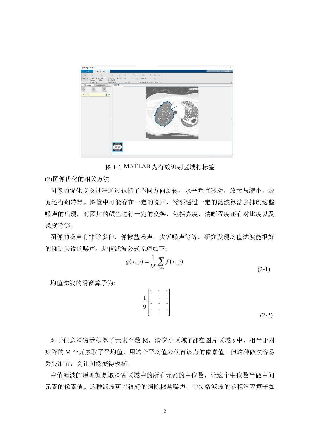 蛇形仿生探测机器人&mdash;&mdash;运动视觉探测系统设计-22460字.docx 第8页