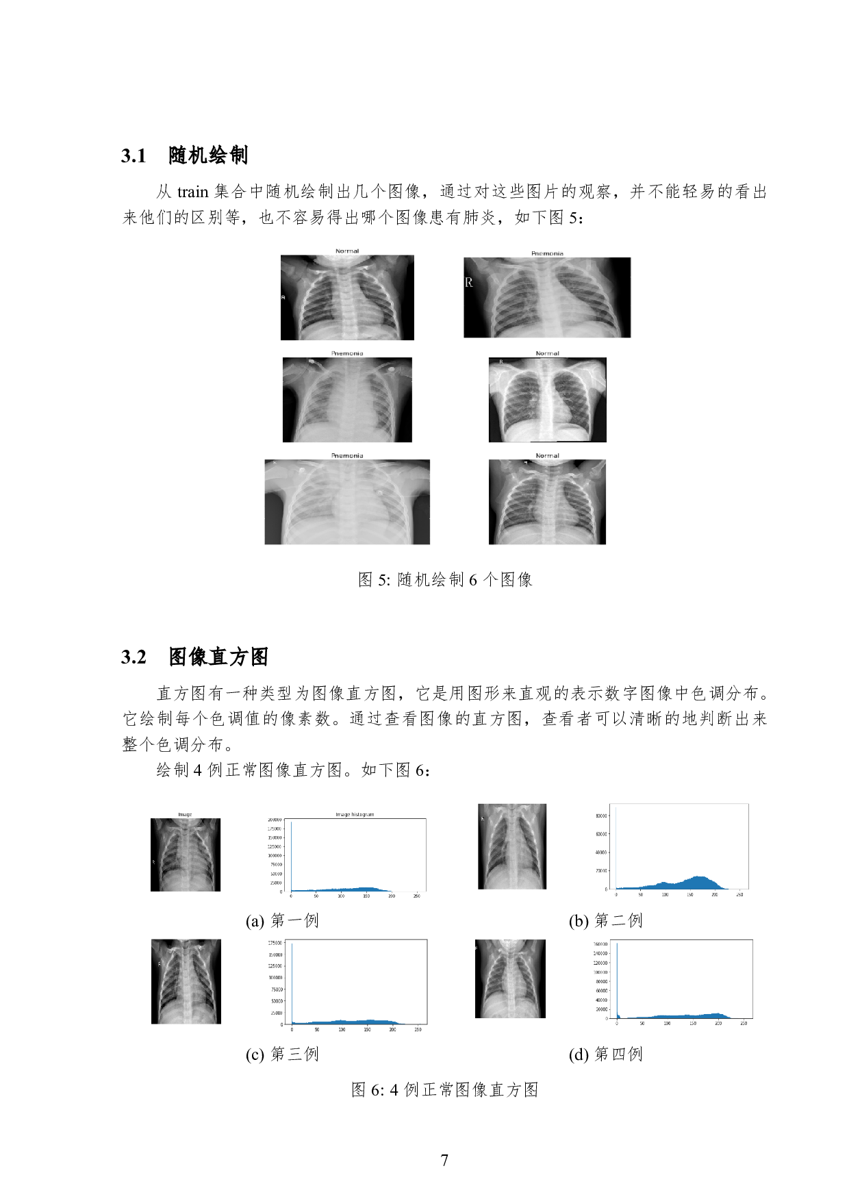 基于深度学习的肺炎胸片图像分类研究-6912字.pdf 第10页