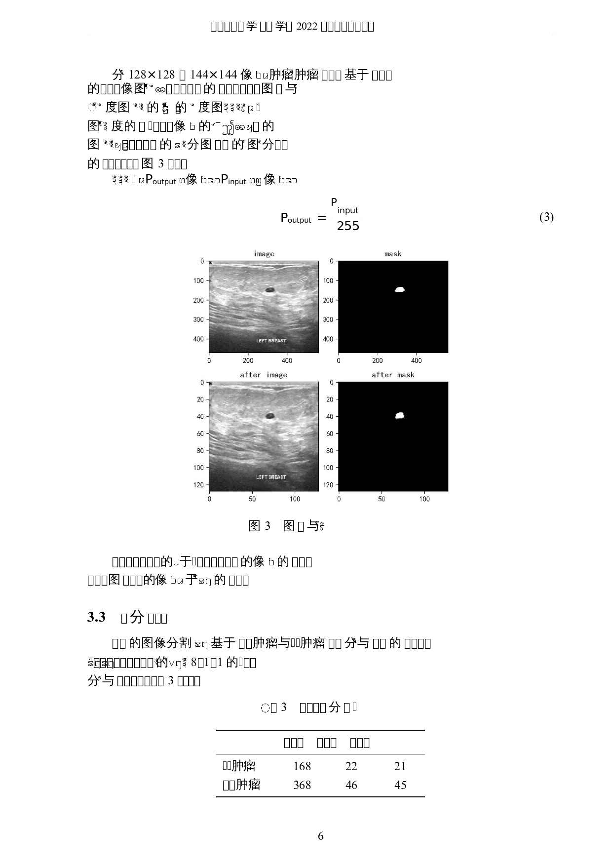 基于深度学习的乳腺癌肿瘤图像分割的分析与研究-5783字.docx 第9页
