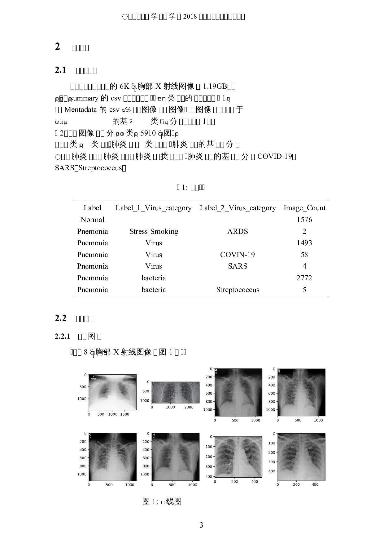 基于深度学习及胸部X射线图像的肺炎分类研究-4692字.docx 第6页
